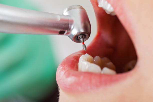 Best Pediatric Emergency Dentist in Oakland, SC
